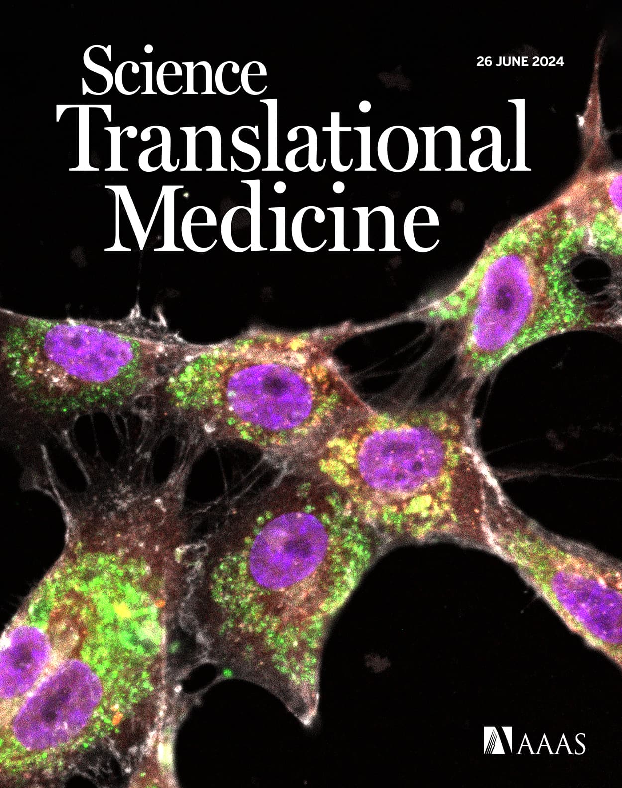 Transcobalamin receptor antibodies in autoimmune vitamin B12 central deficiency